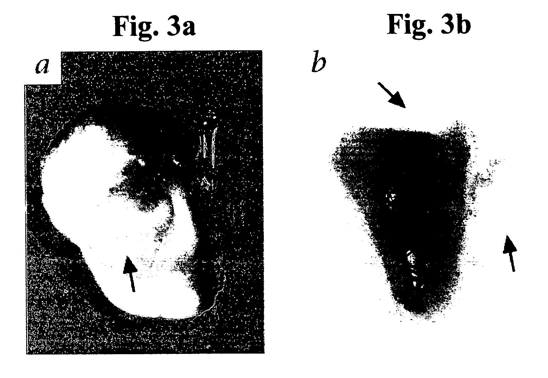 Methods of treating disease by transplantation of developing allogeneic or xenogeneic organs or tissues