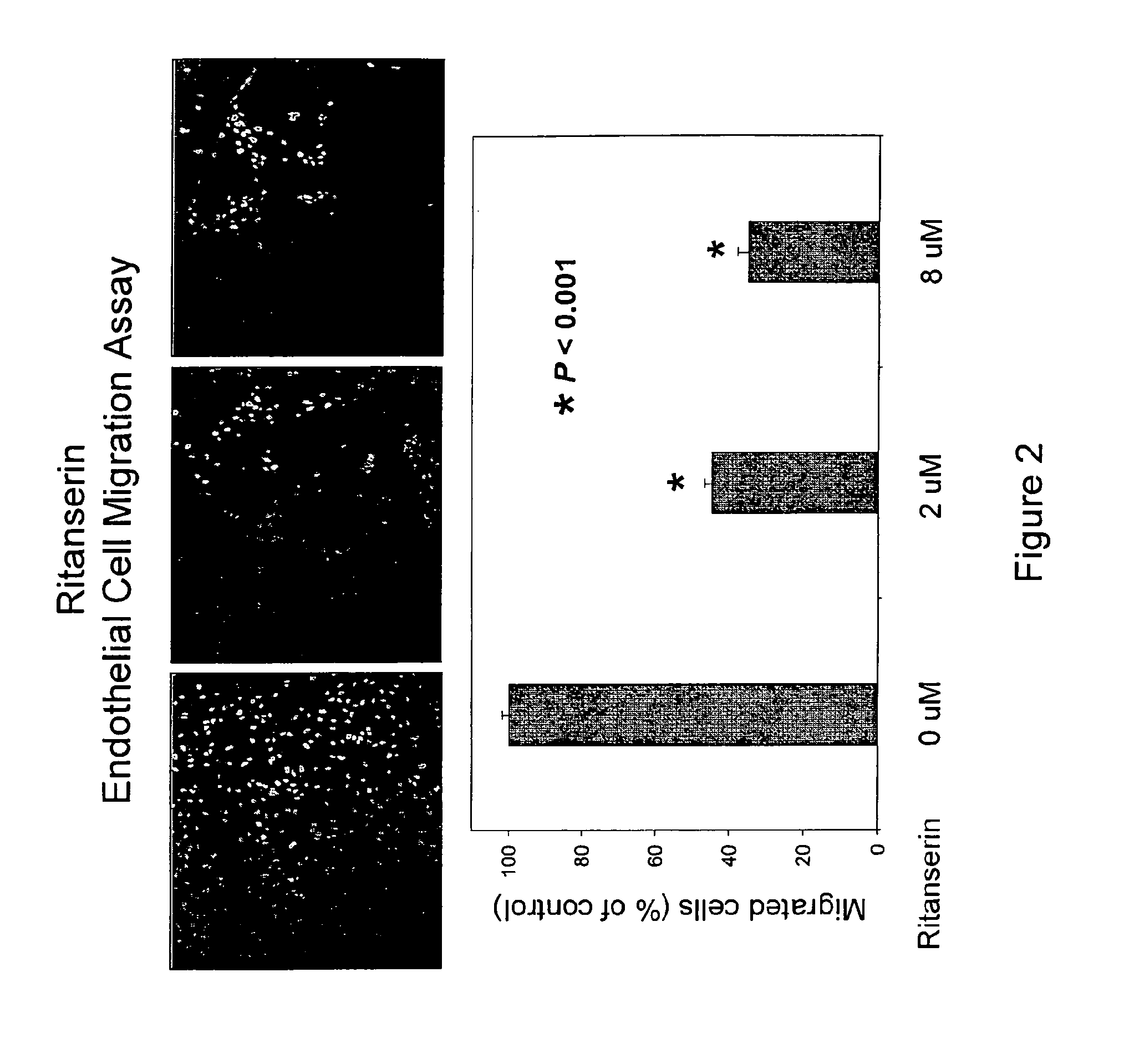 Method of using biothionol and biothionol-like compounds as anti-angiogenic agents