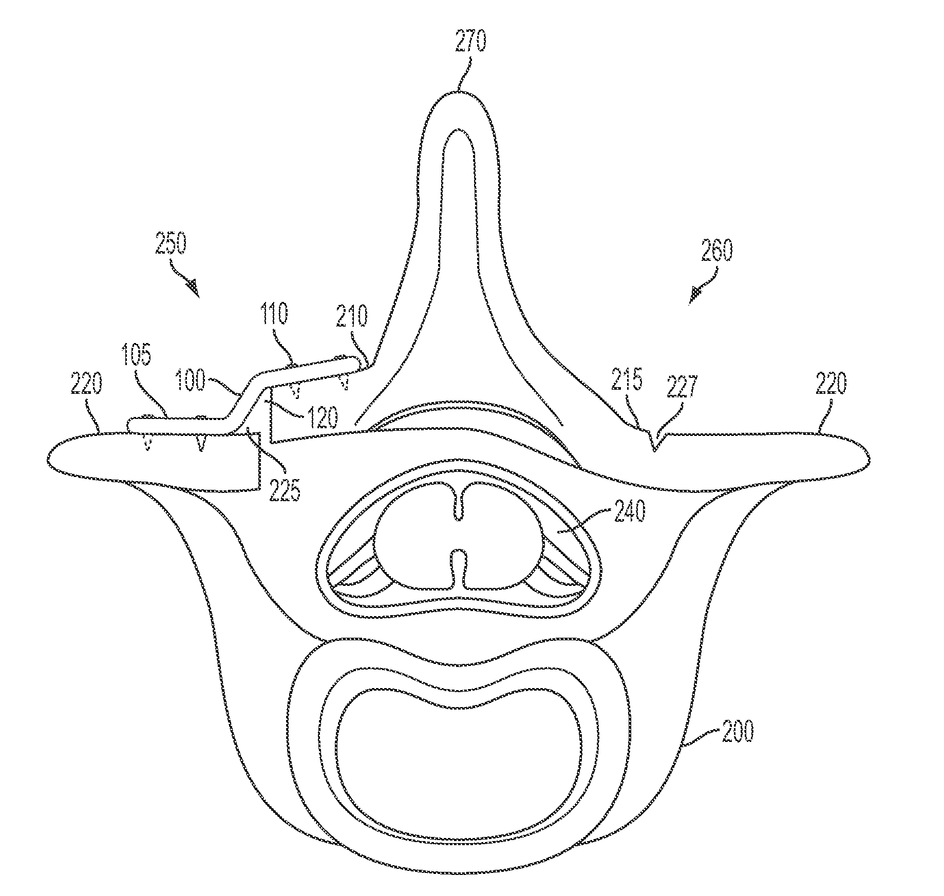 Surgical access system