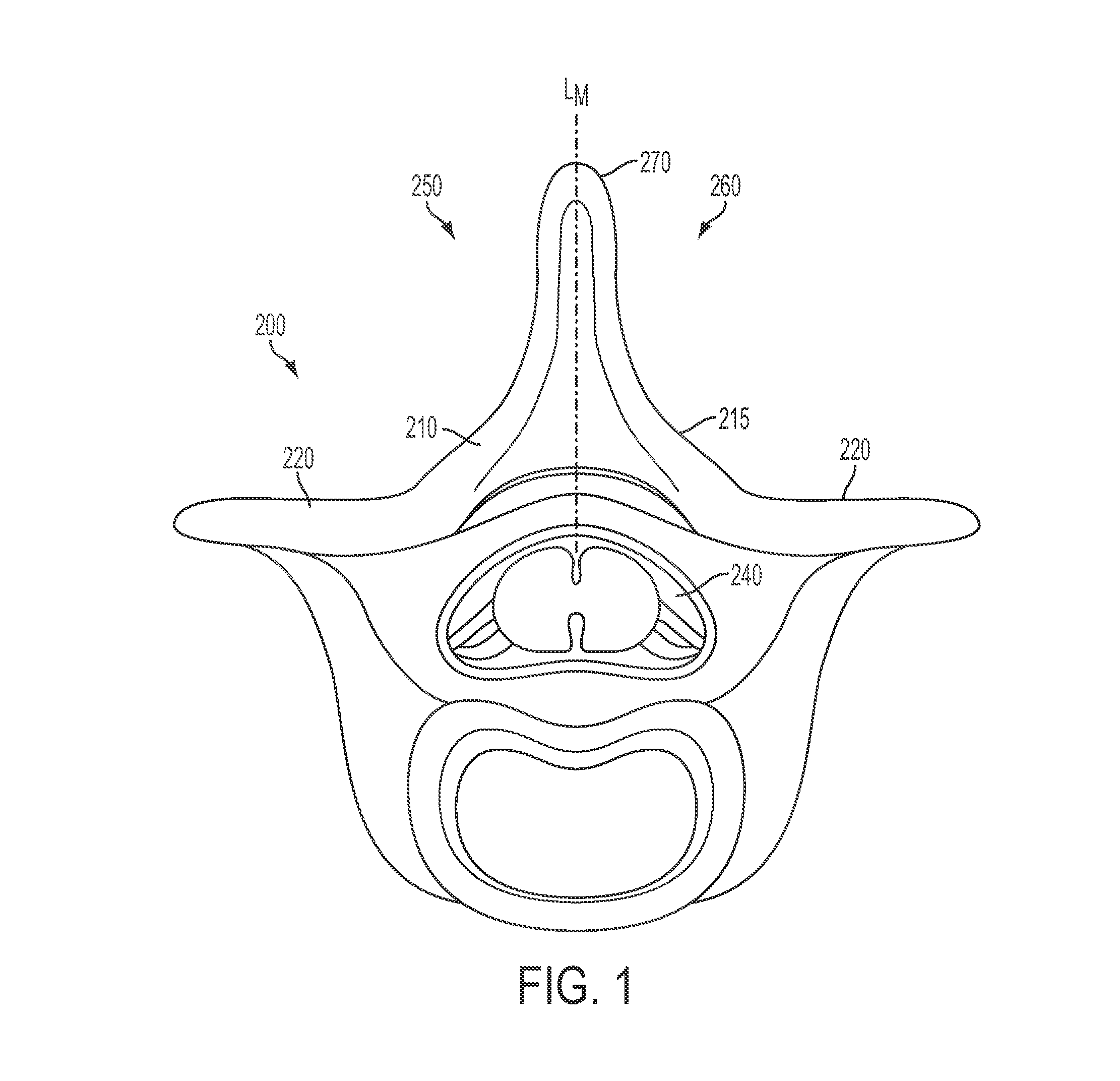 Surgical access system