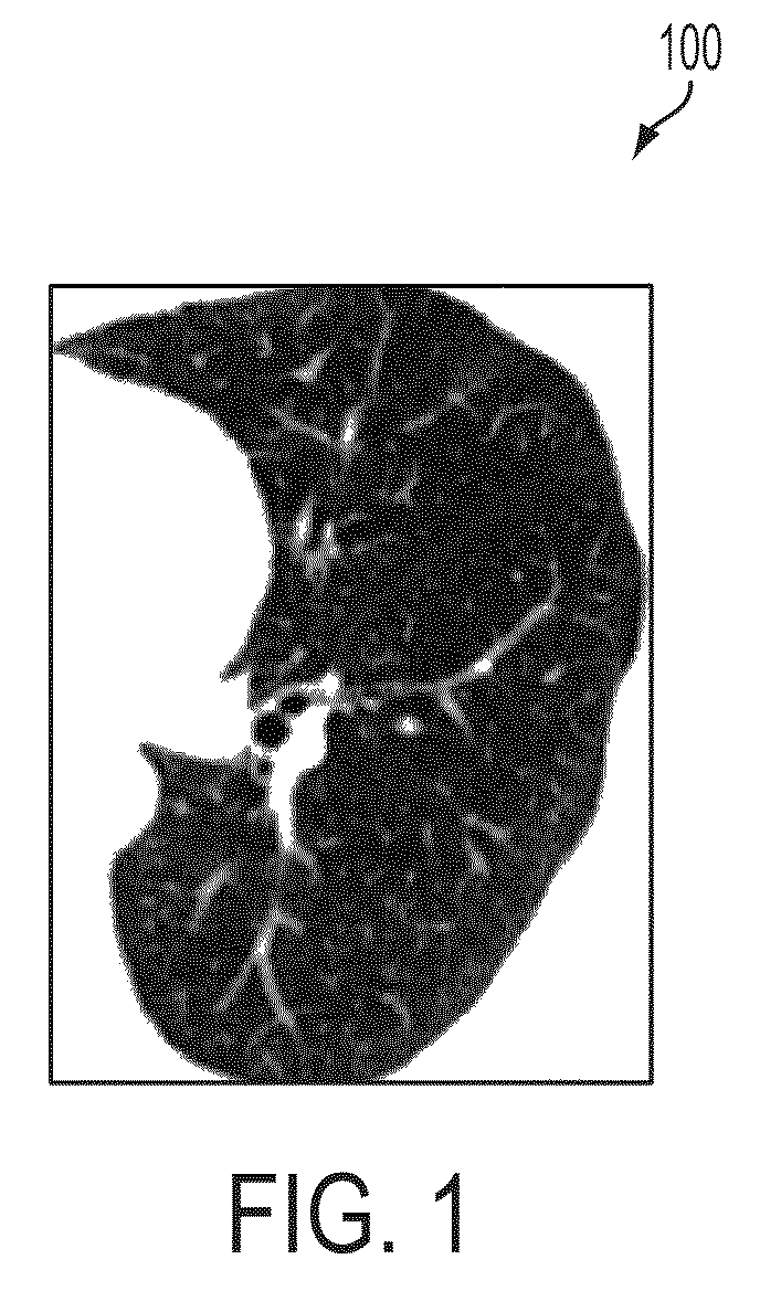 Method and apparatus for airway detection and segmentation using 3D morphological operators