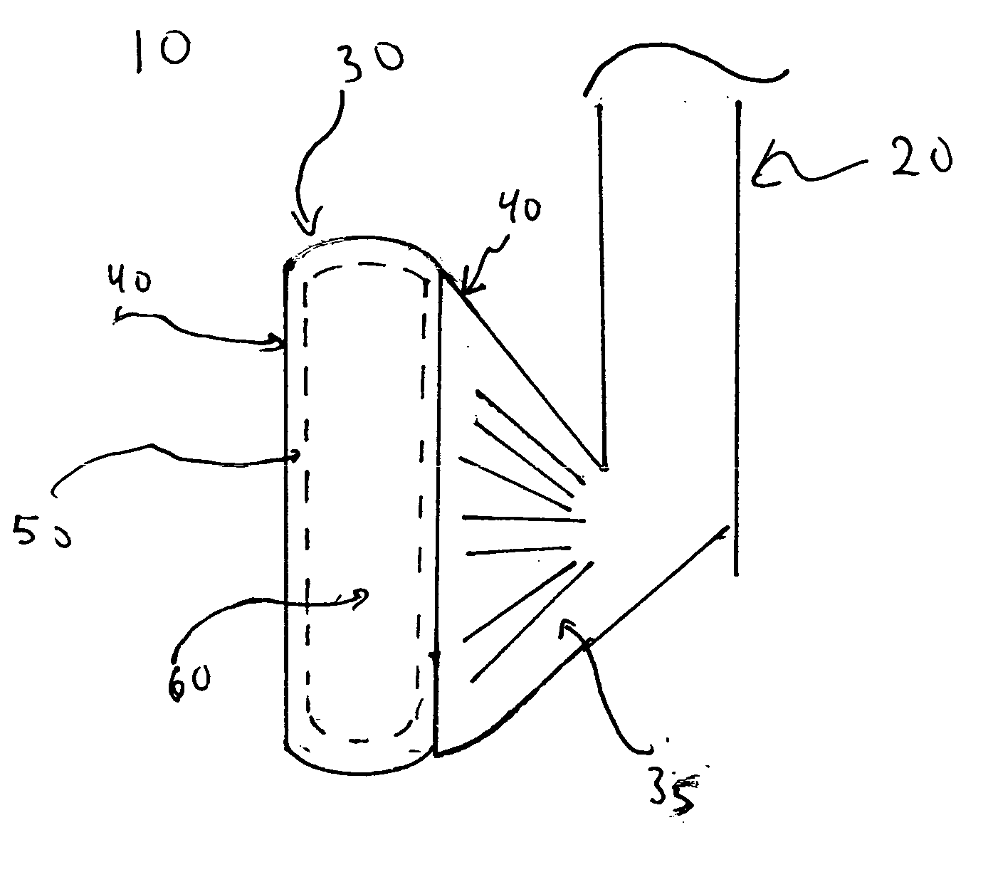 Case-hardened stainless steel foundry alloy and methods of making the same