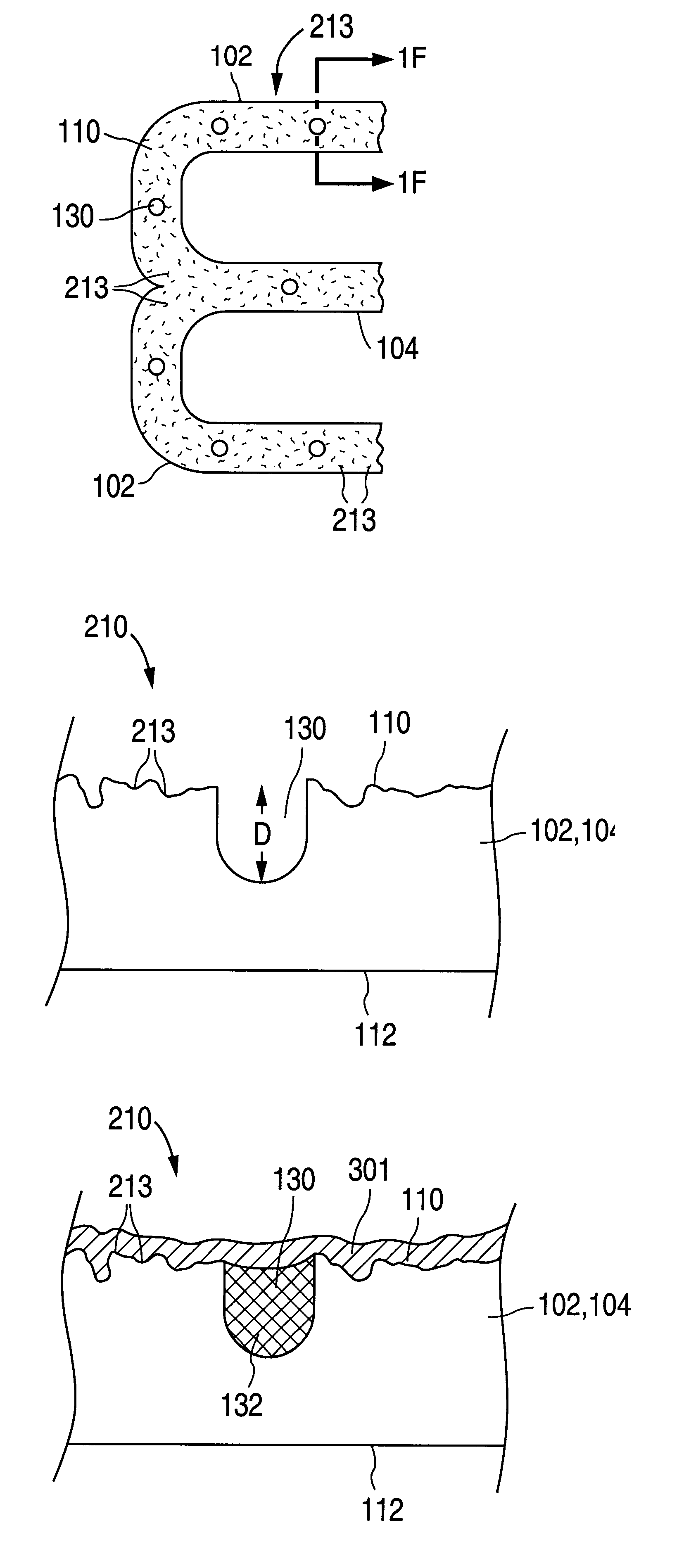 Method for creating a textured surface on an implantable medical device