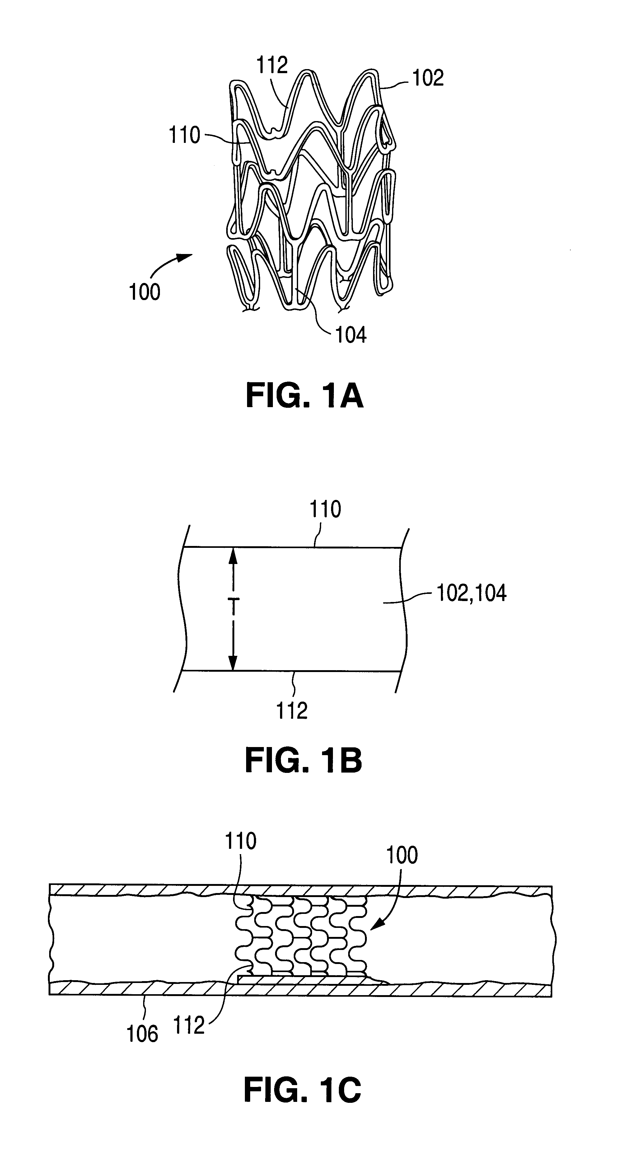 Method for creating a textured surface on an implantable medical device