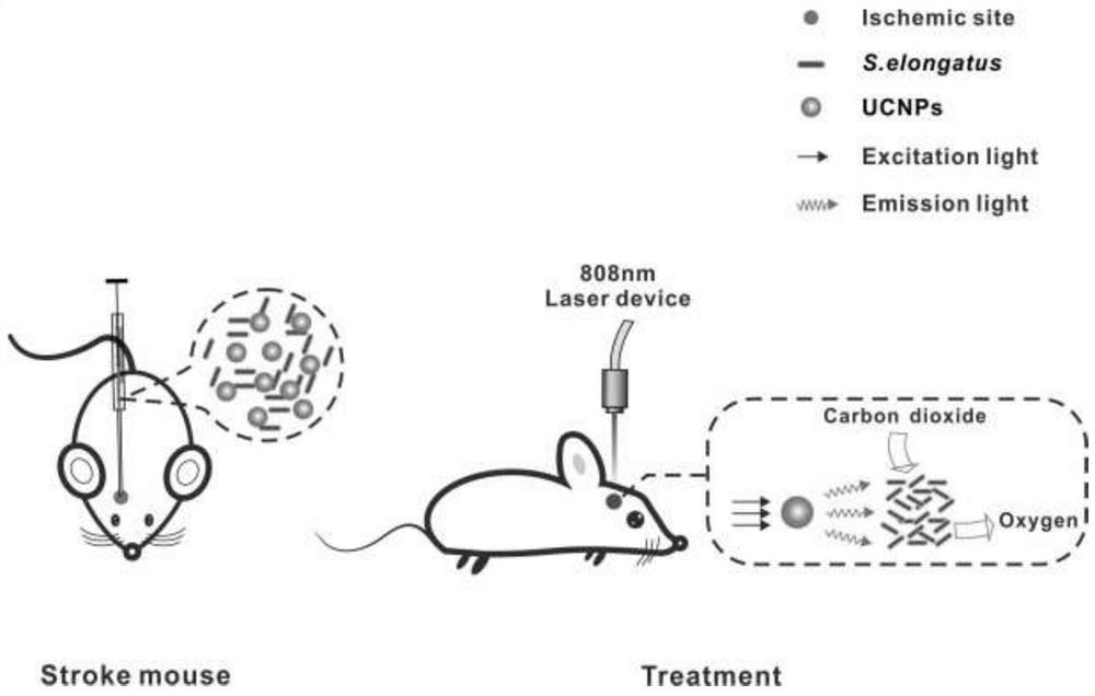 A therapeutic liquid for treating ischemic stroke, its preparation method and application