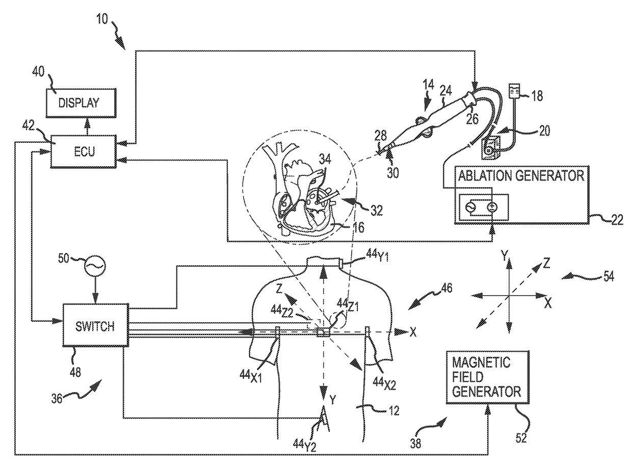 Utilization of electrode spatial arrangements for characterizing cardiac conduction conditions