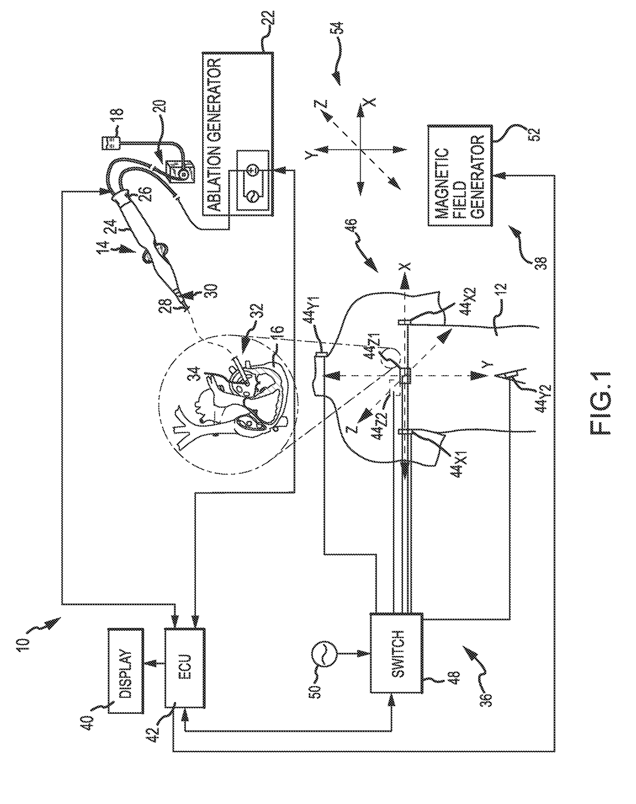 Utilization of electrode spatial arrangements for characterizing cardiac conduction conditions