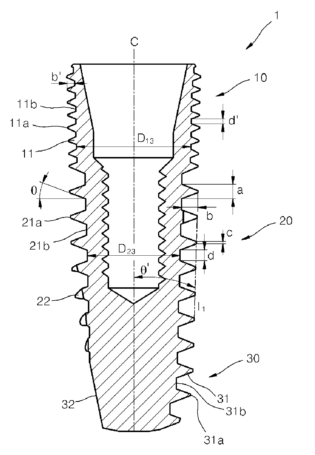 Dental implant fixture