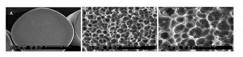 Method for preparing two-stage micron-submicron microstructure on surface of titanium alloy dental implant