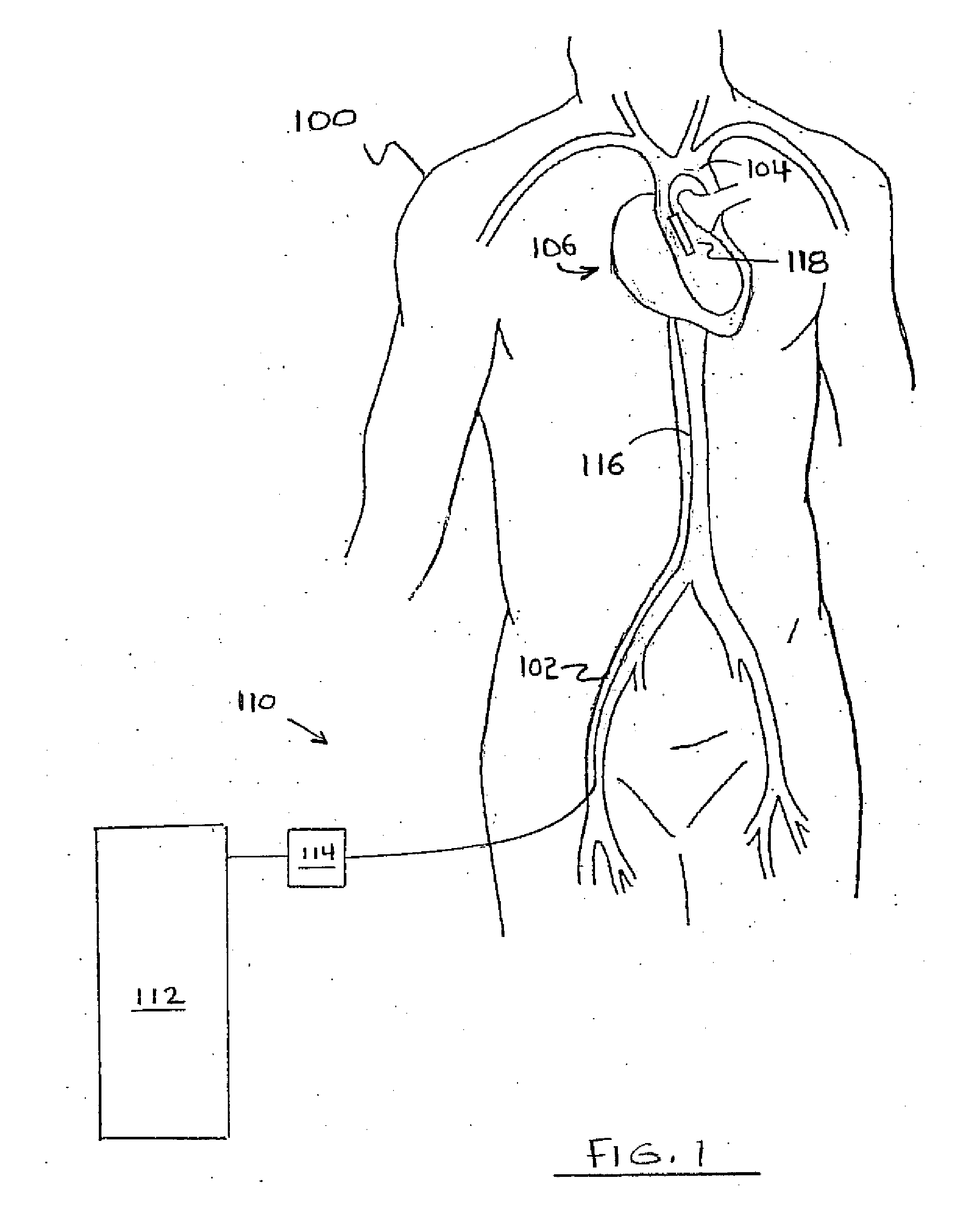 Medical Device