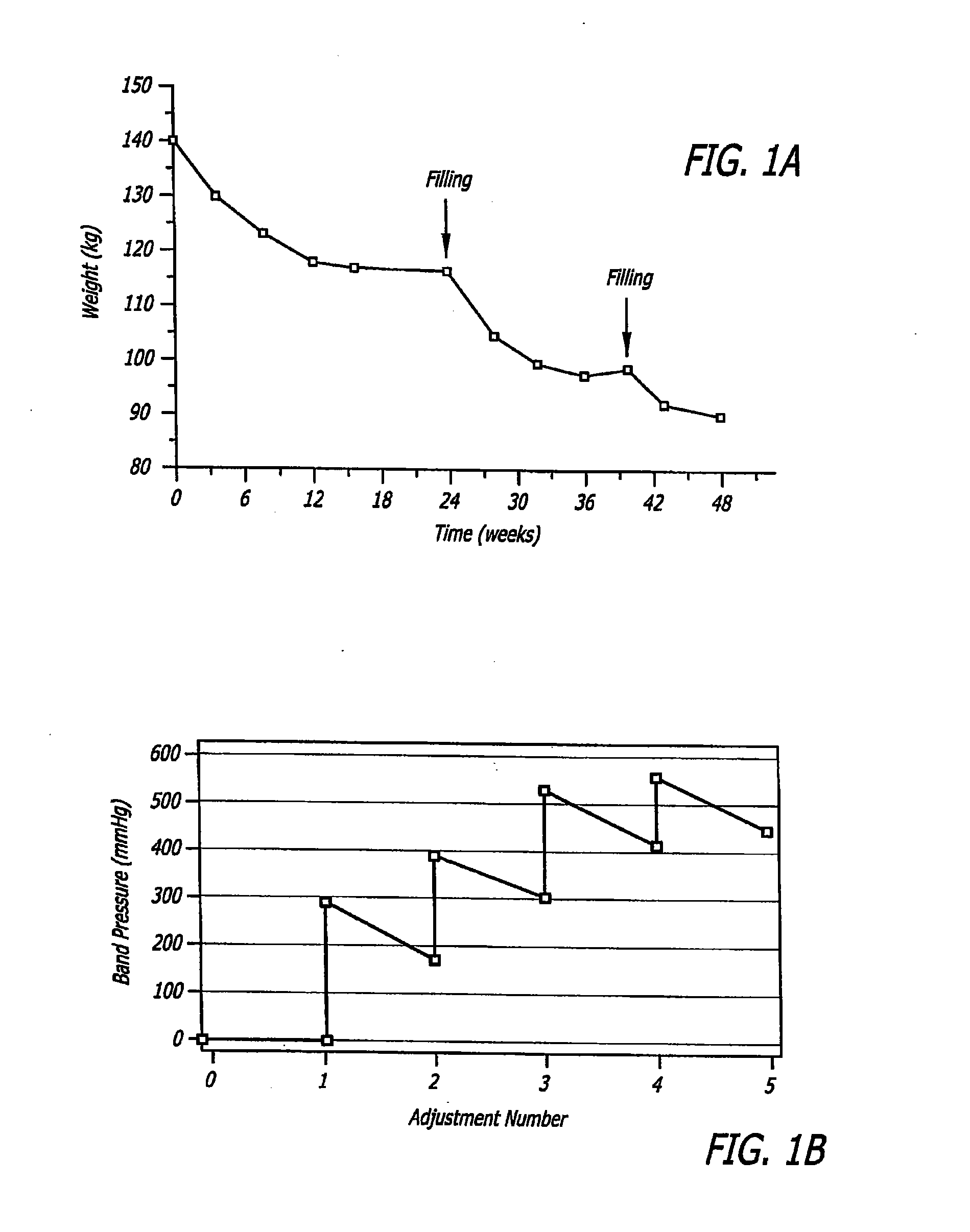 Method for modulating changes in intra-band pressure in a gastric band