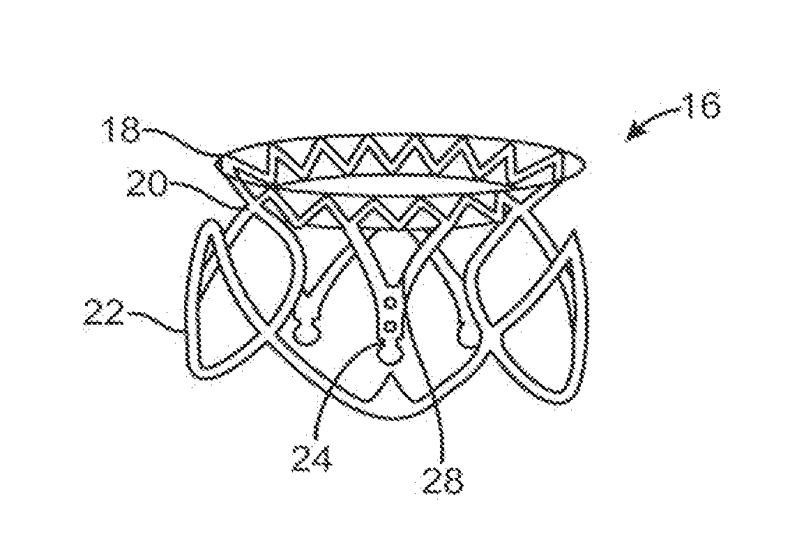 Transcatheter mitral valve prosthesis