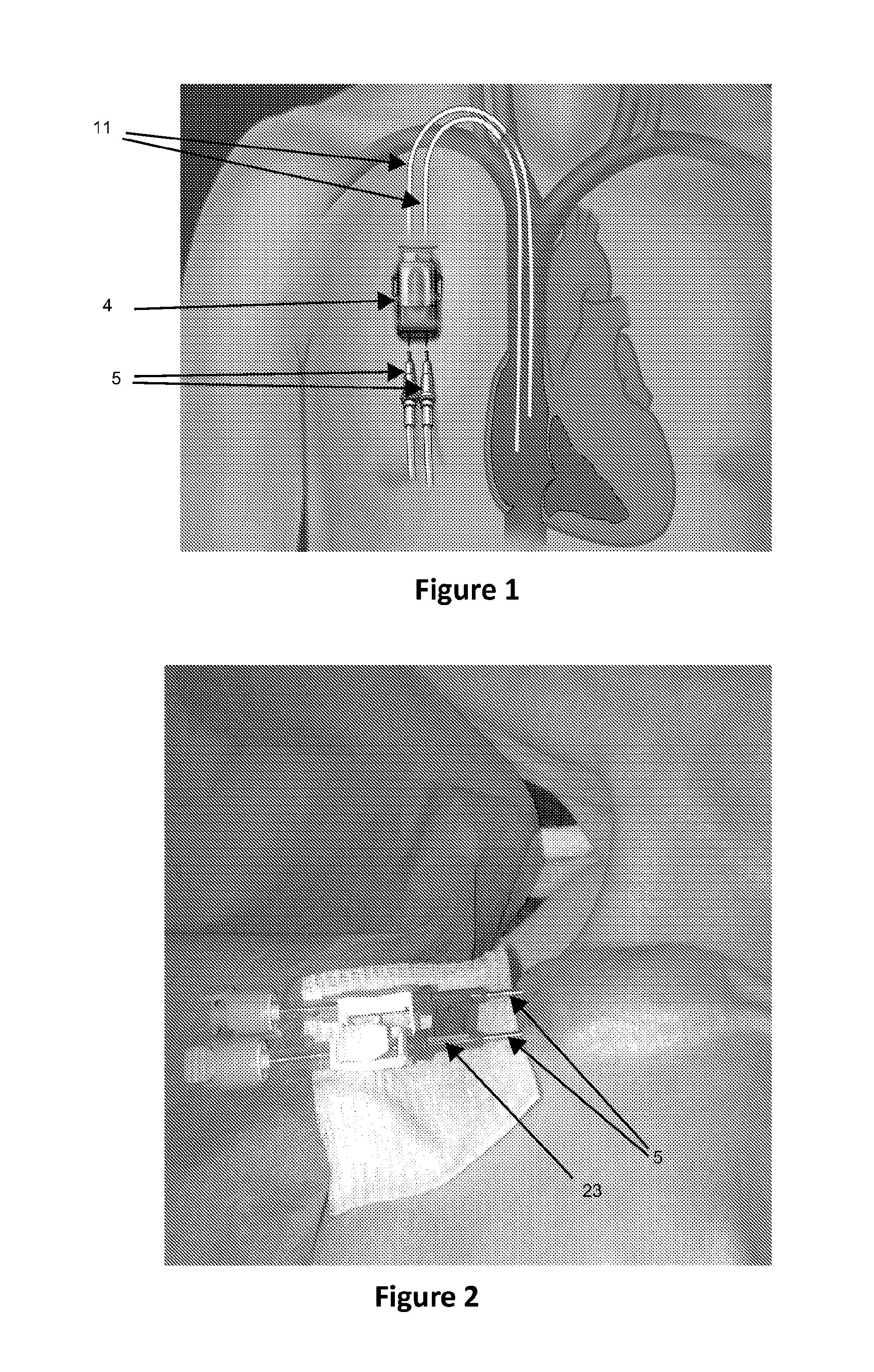 Hemodialysis access system