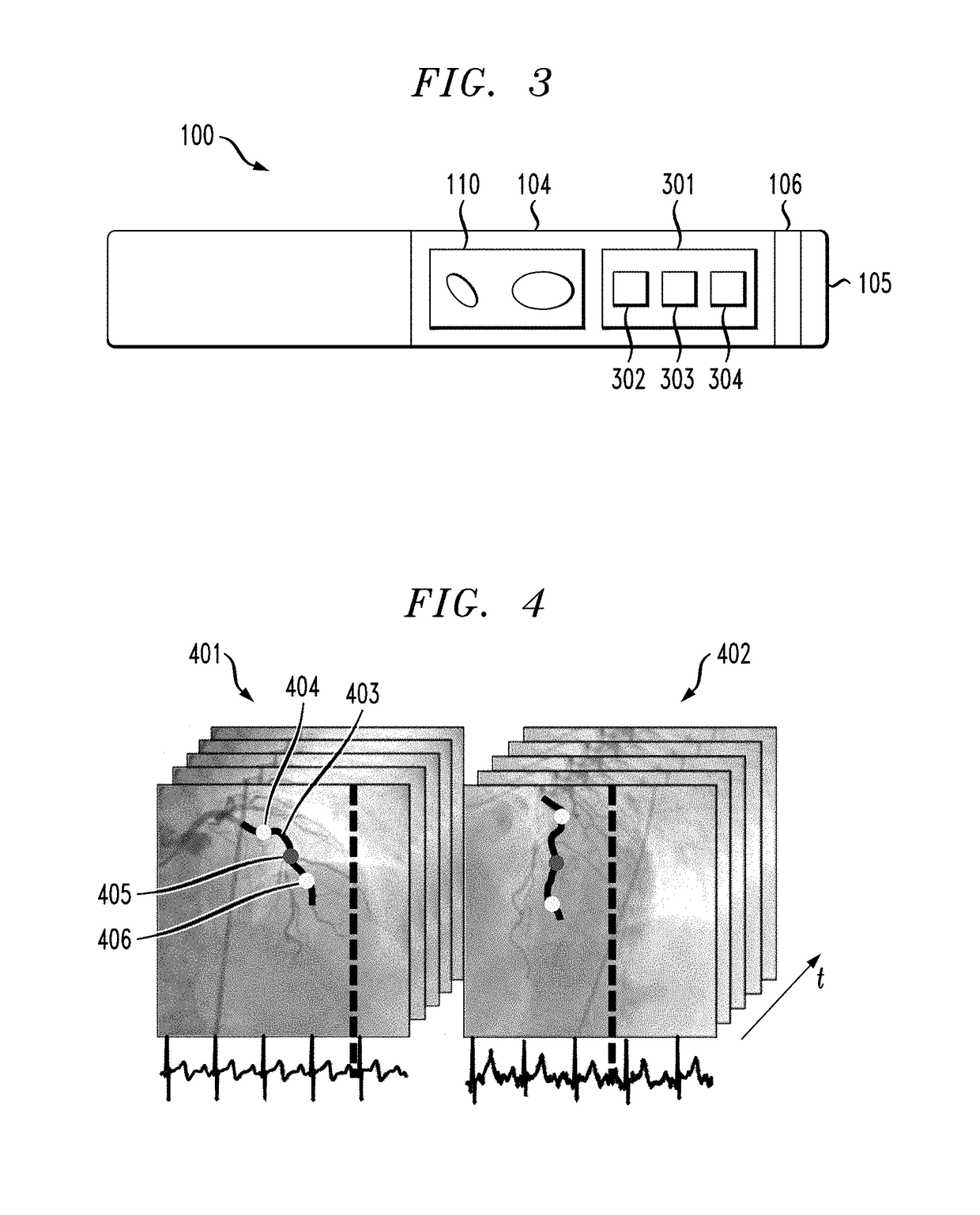 Intravascular catheter for modeling blood vessels