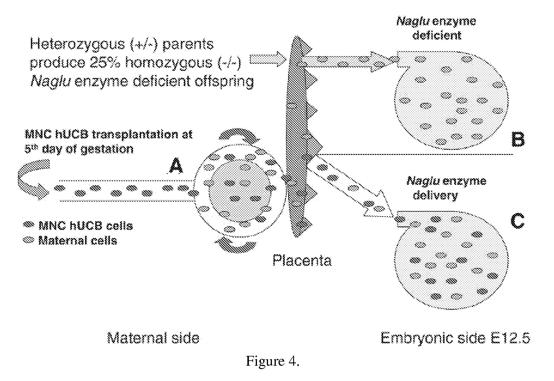 Method of prenatal administration of mammalian umbilical cord stem cells for the intrauterine treatment of sanfilippo syndrome