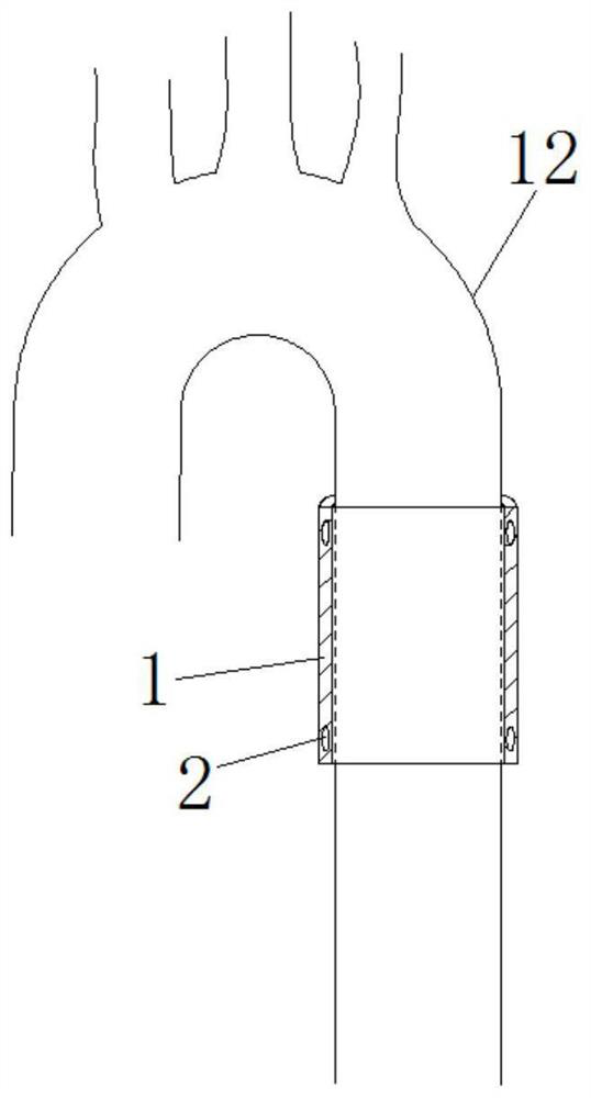 Blood pulse wave adjusting device