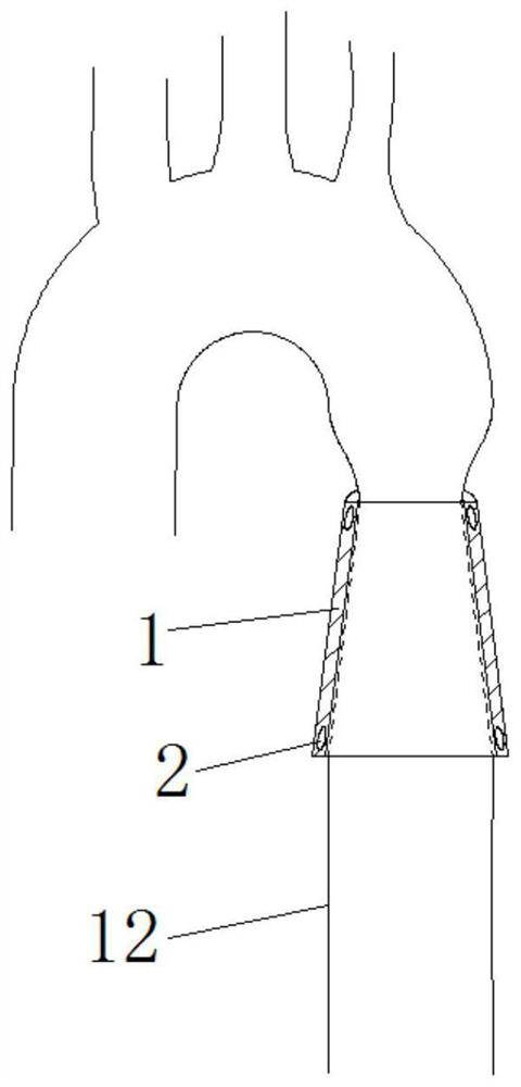 Blood pulse wave adjusting device