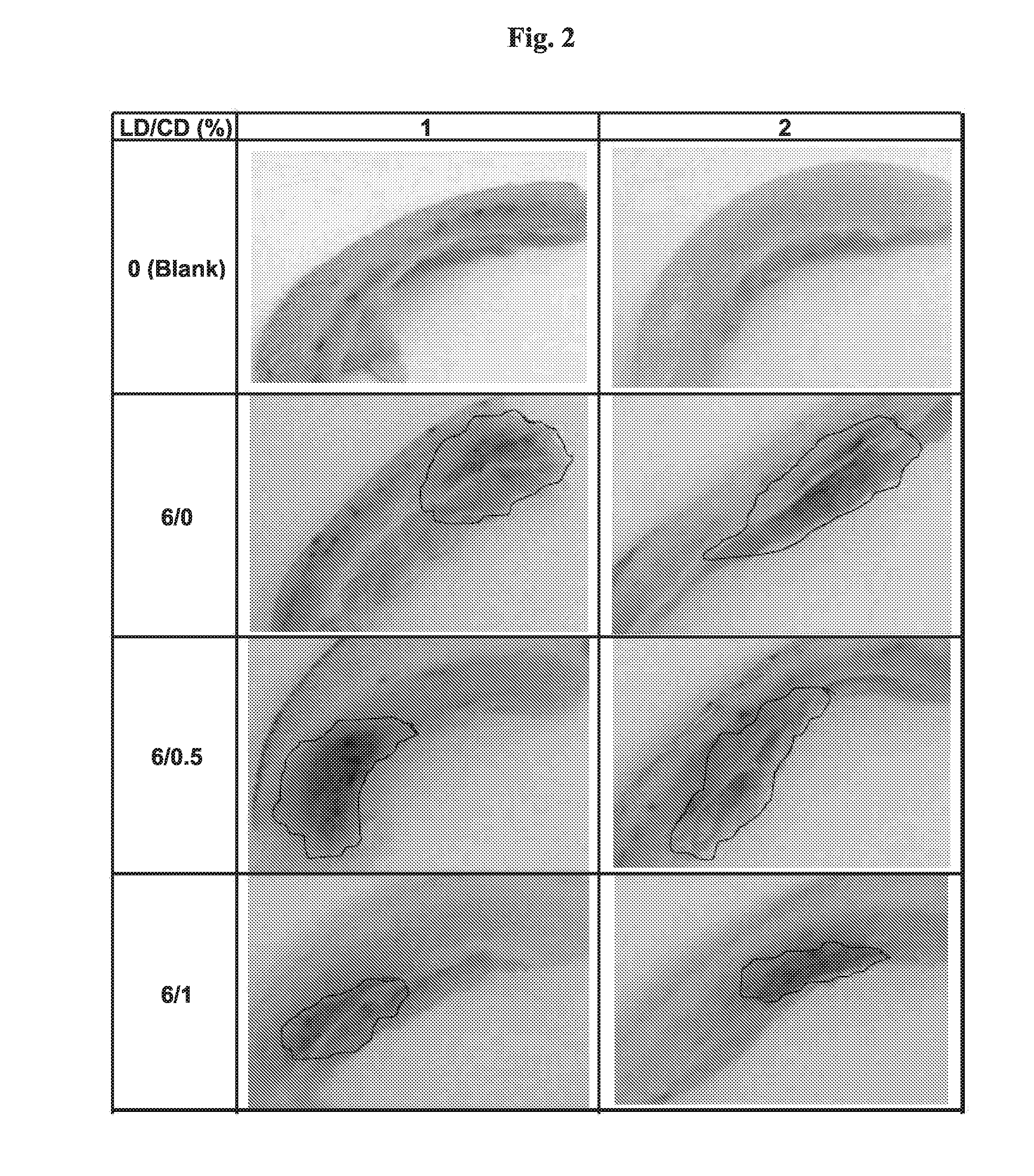 Method for treatment of parkinson's disease