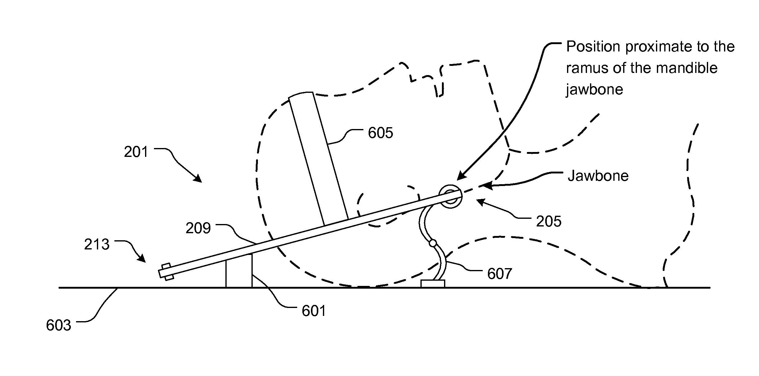 Jaw thrust apparatus