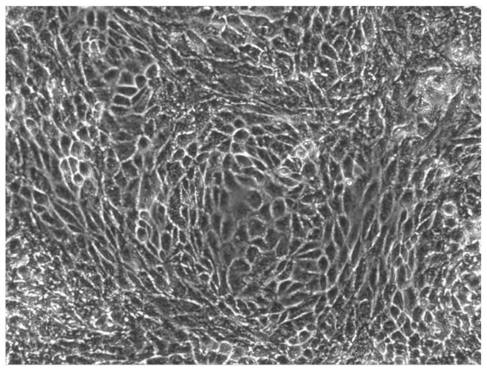 Culture medium for inducing human embryonic stem cells to differentiate into liver-like tissue, induction method and application