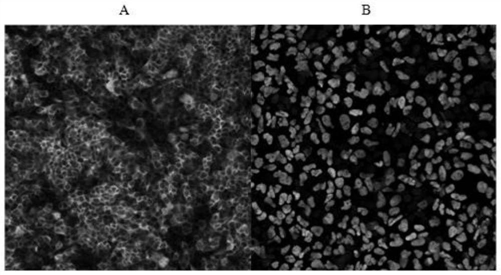 Culture medium for inducing human embryonic stem cells to differentiate into liver-like tissue, induction method and application