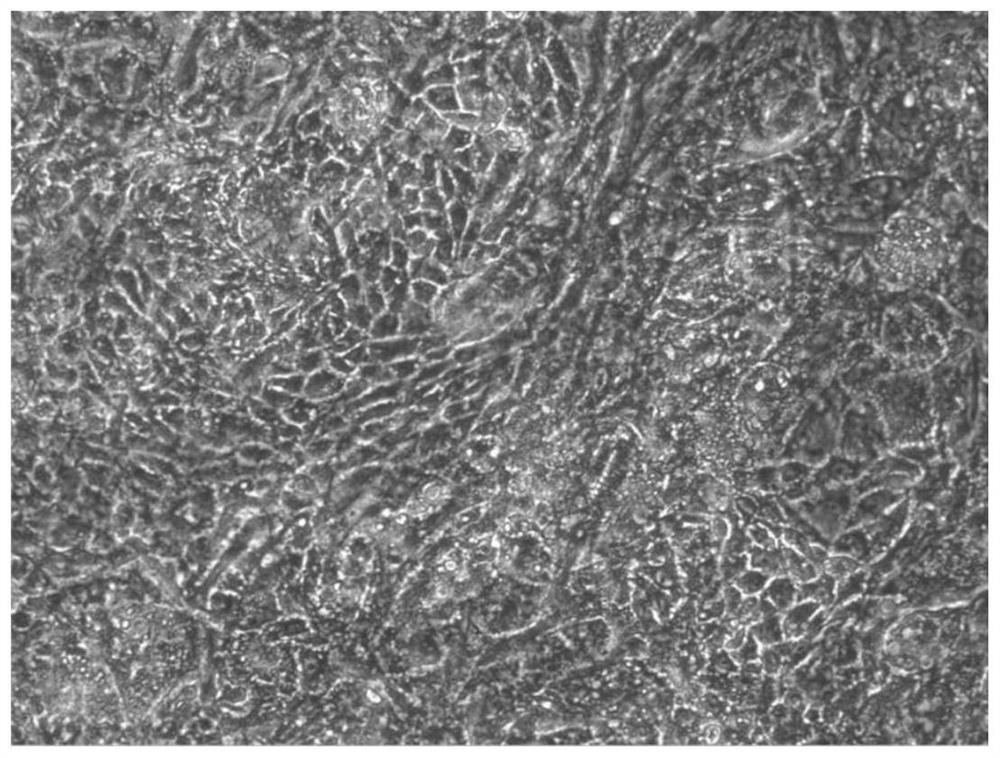 Culture medium for inducing human embryonic stem cells to differentiate into liver-like tissue, induction method and application