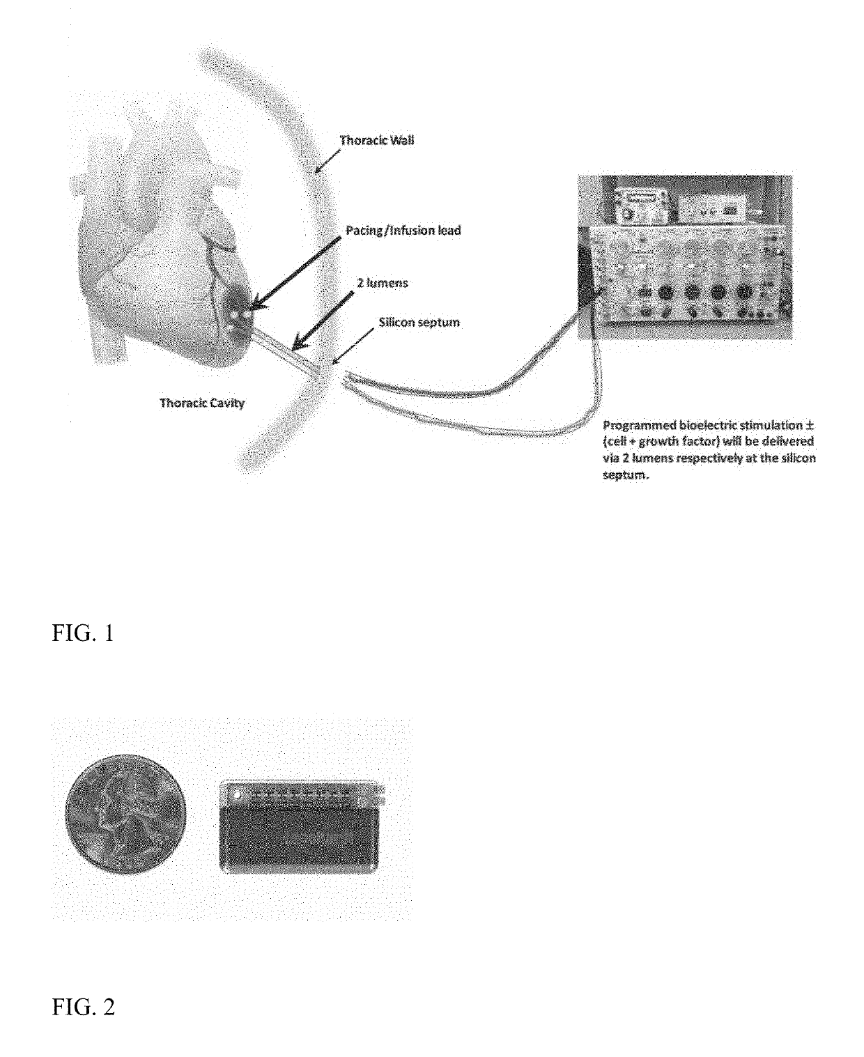 Stimulator, pump and composition