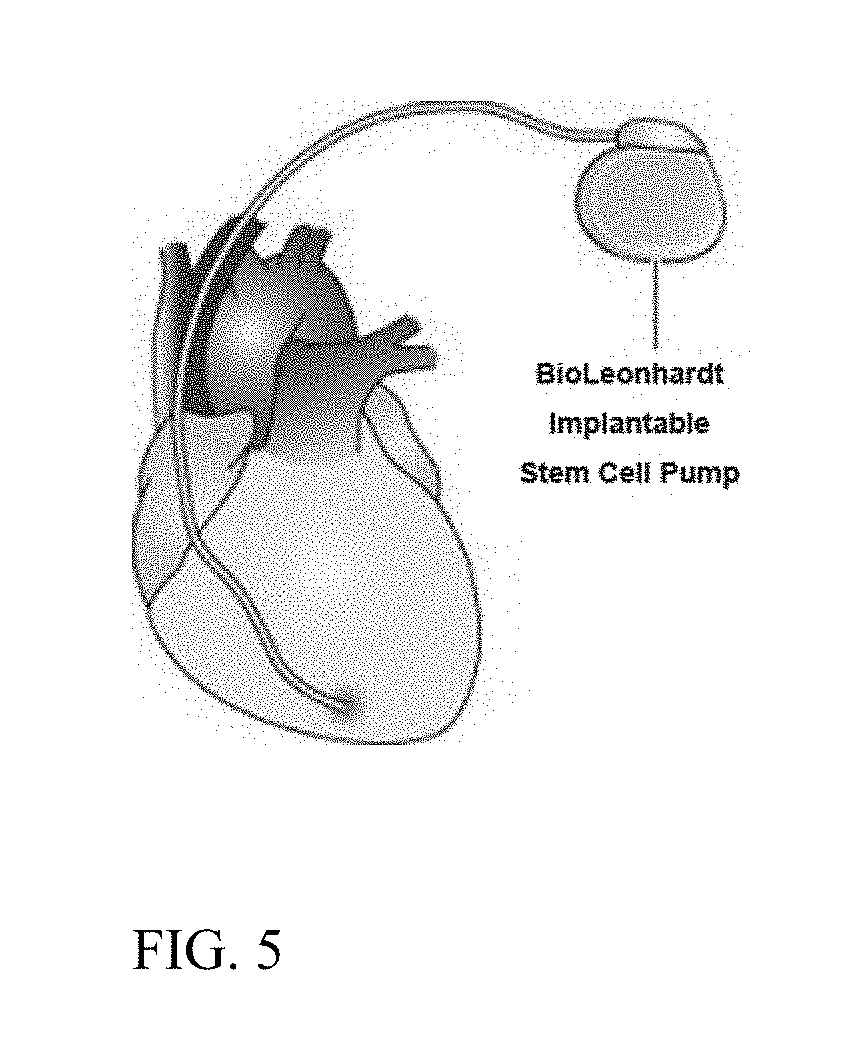 Stimulator, pump and composition