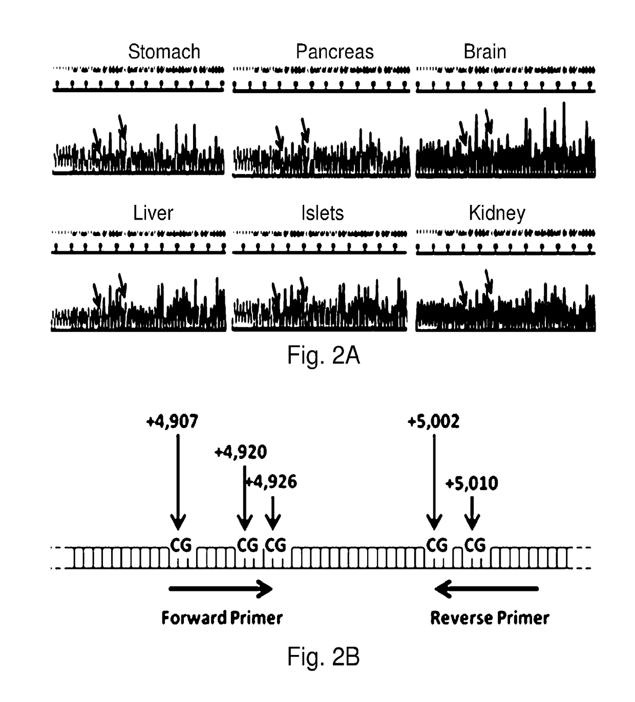 System, method and kit for analysis of circulating differentially methylated DNA as a biomarker of beta-cell loss