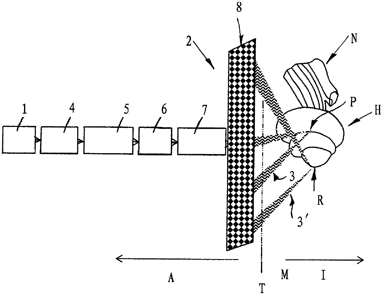 Hearing prosthesis emitting ultrasonic pulses