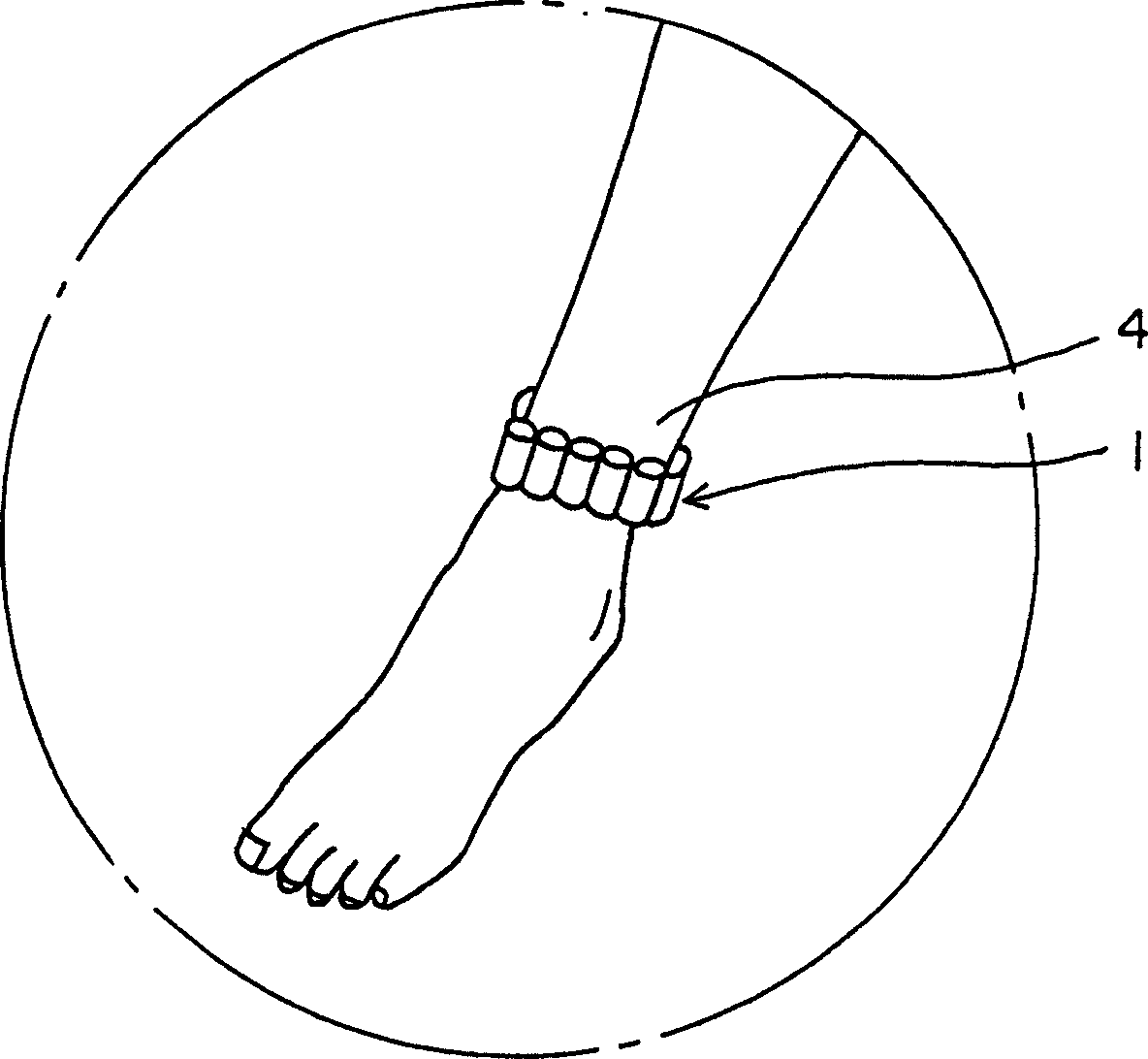 Permanent magnet rings