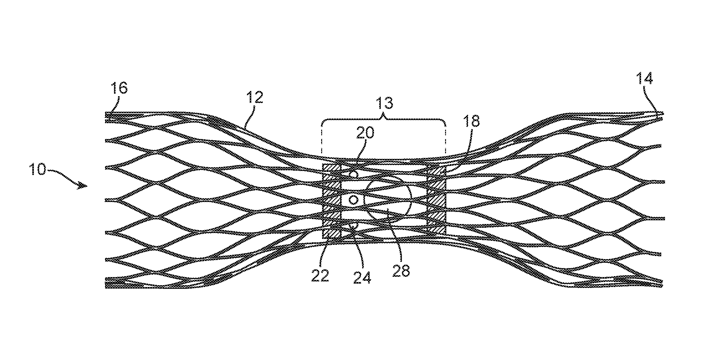 Venous valve prosthesis