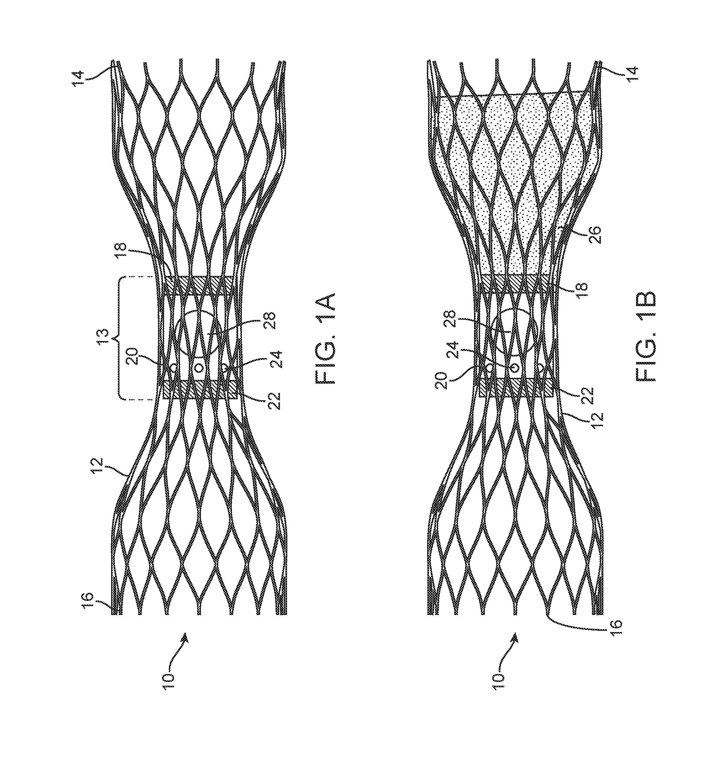 Venous valve prosthesis