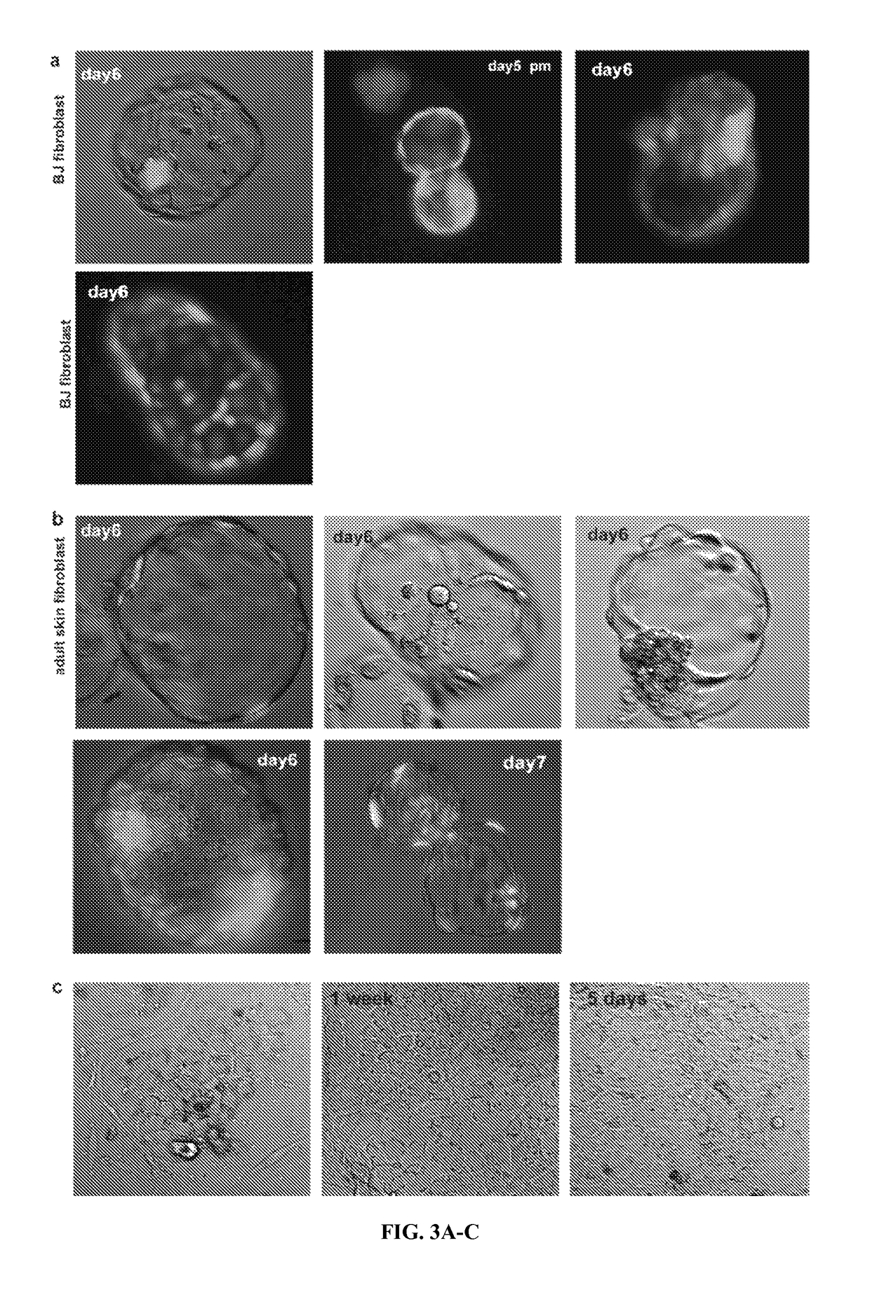 Somatic cell nuclear transfer methods