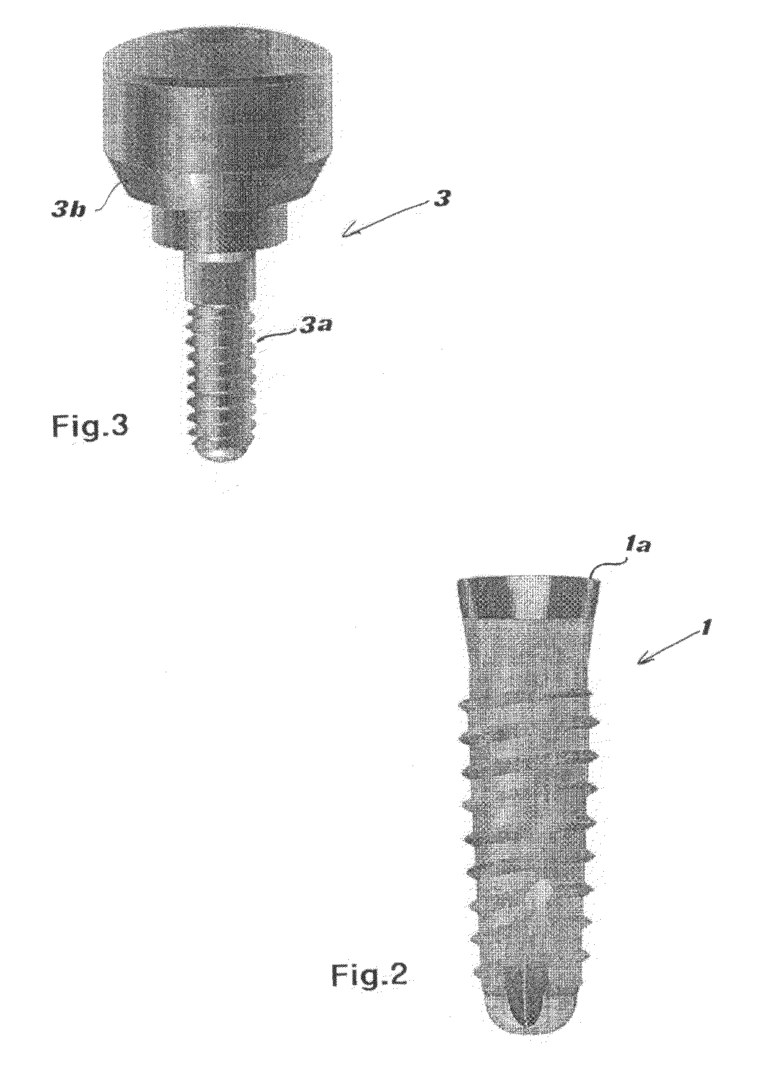 Medicated dental implant