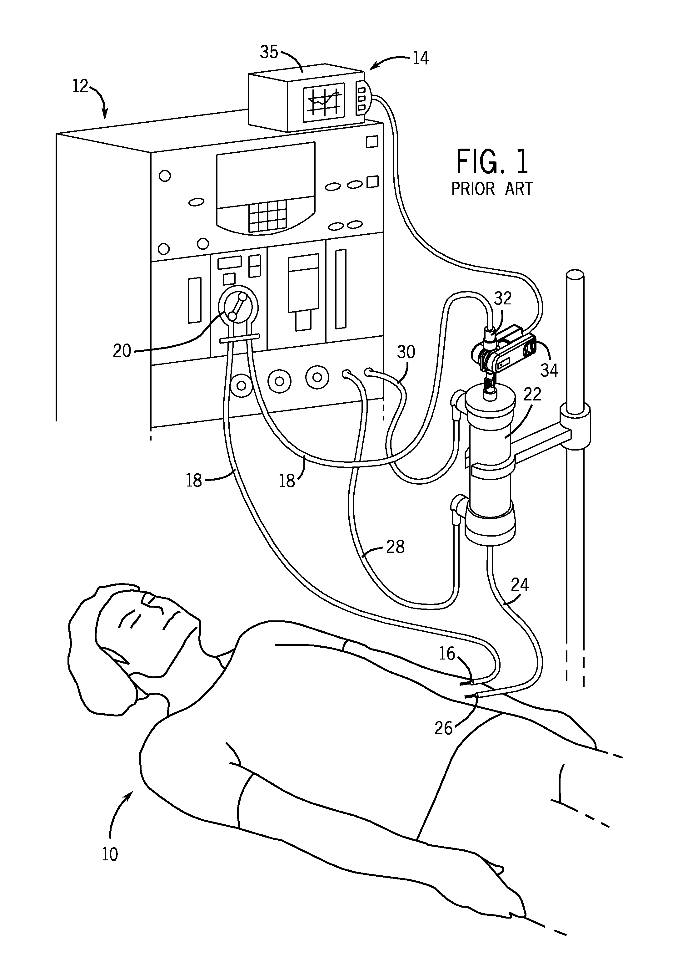 Shrouded sensor clip assembly and blood chamber for an optical blood monitoring system