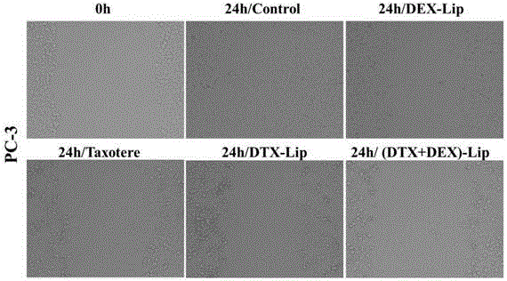 Anticancer composition as well as preparation and application thereof