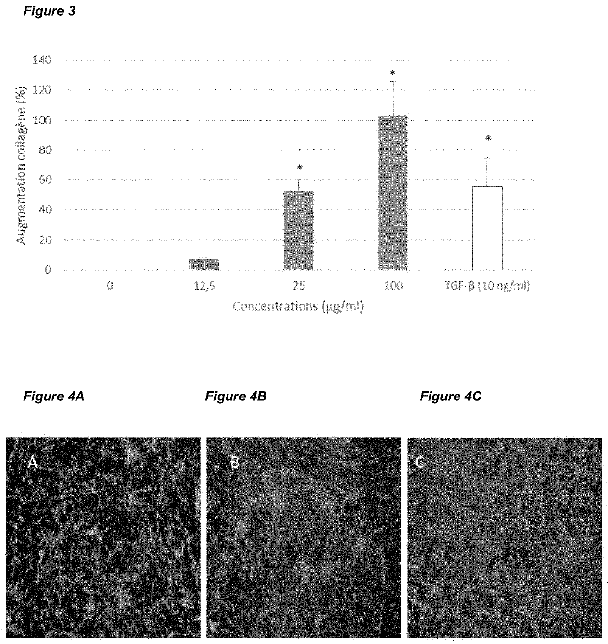 Tree bark extract as anti-aging composition and uses thereof