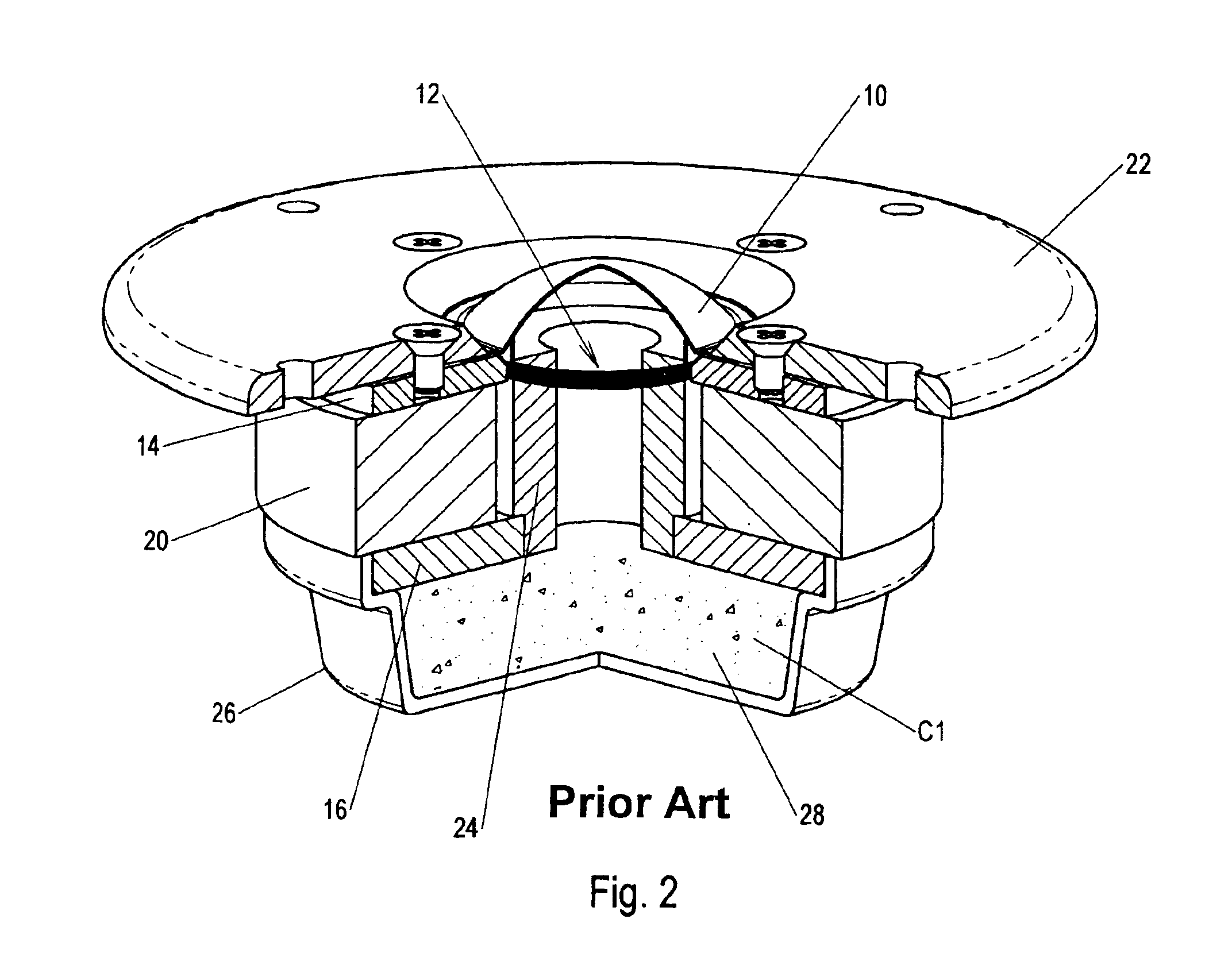 Dipole radiating dynamic speaker