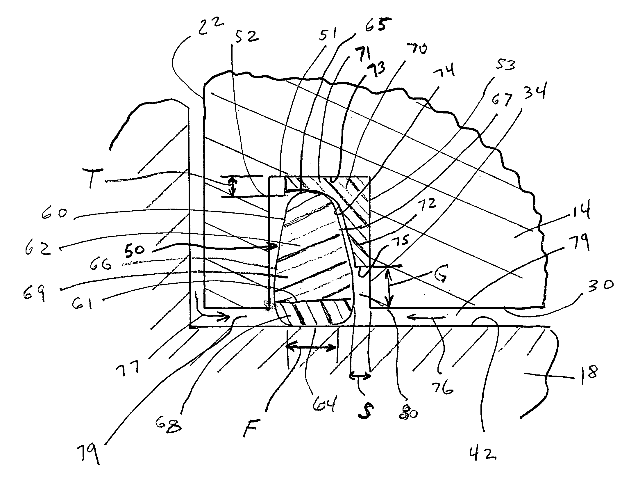 Elastomeric seal assembly having auxiliary annular seal components