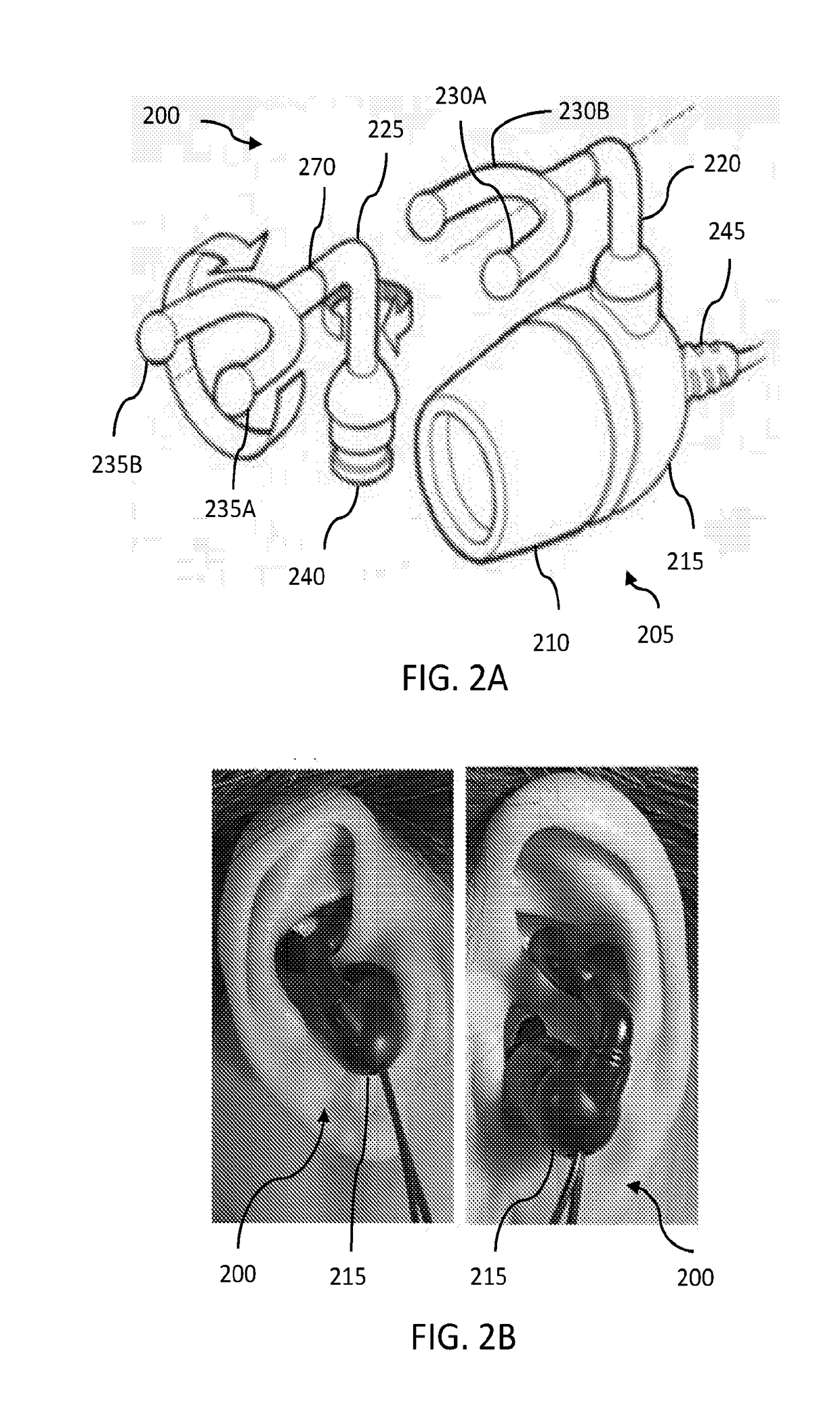 System and method for ear-arranged transcutaneous vagus nerve stimulation