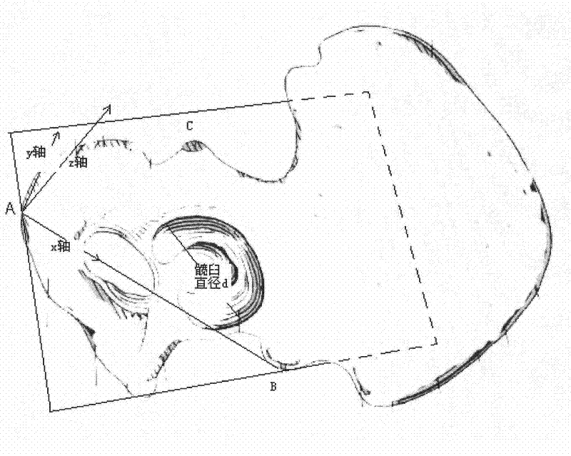 Measuring method of acetabular bones of human bodies