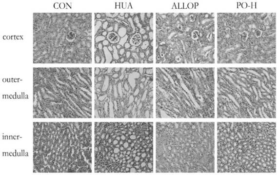 Portulaca oleracea active component and preparation method and application thereof