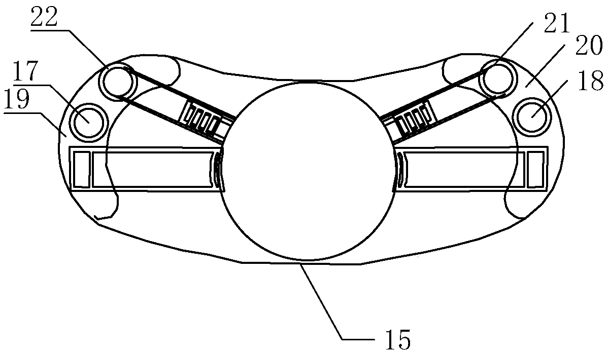 Electronic intestinal stoma