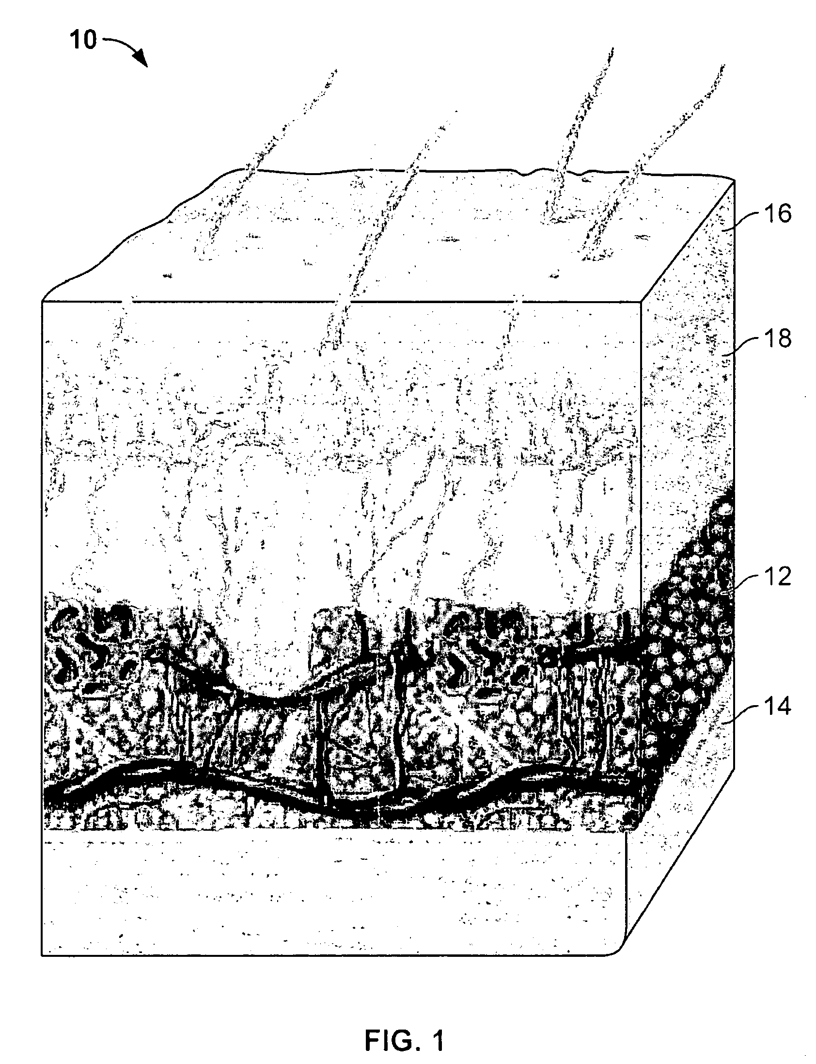 Cartridge electrode device