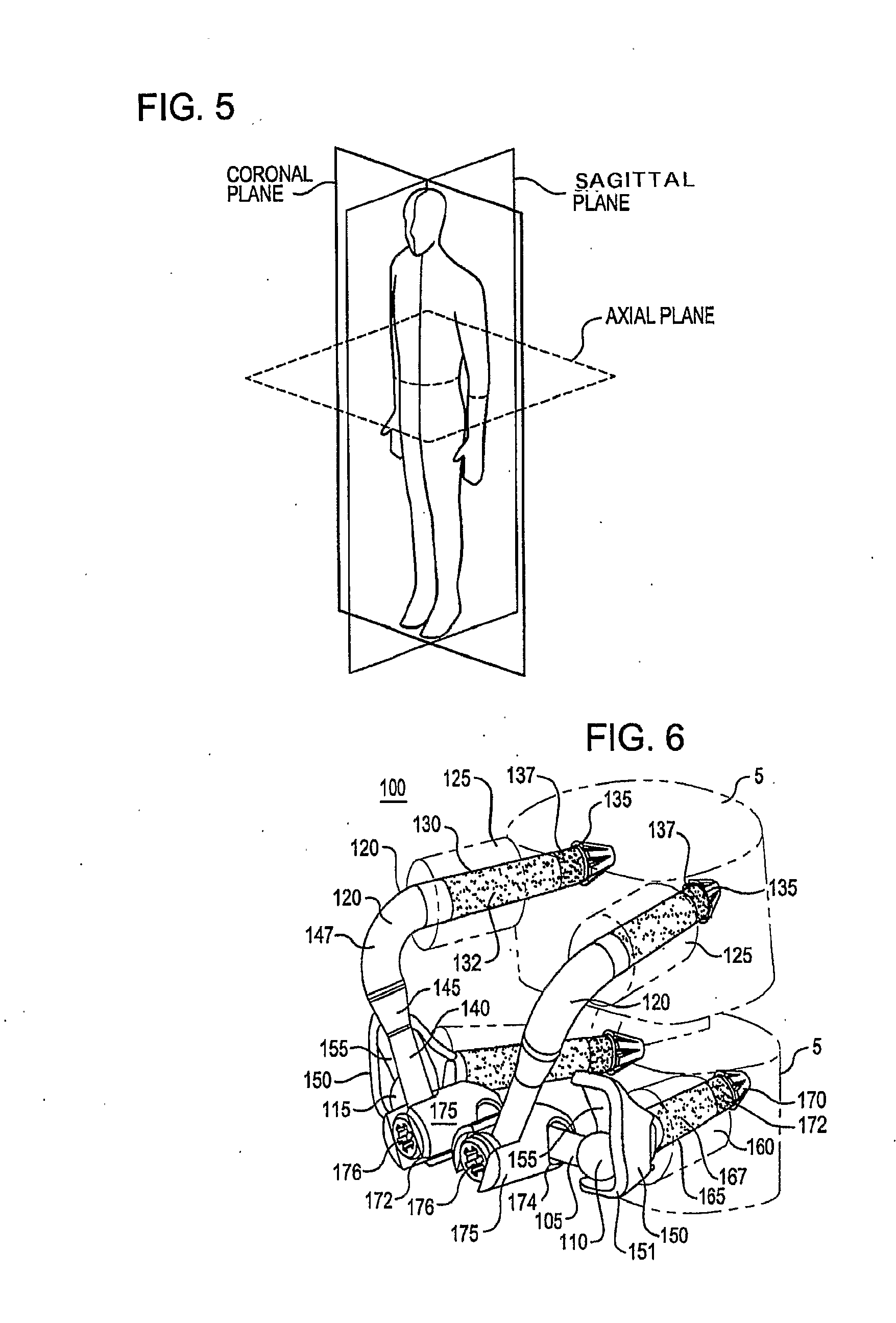 Crossbar spinal prosthesis having a modular design and systems for treating spinal pathologies