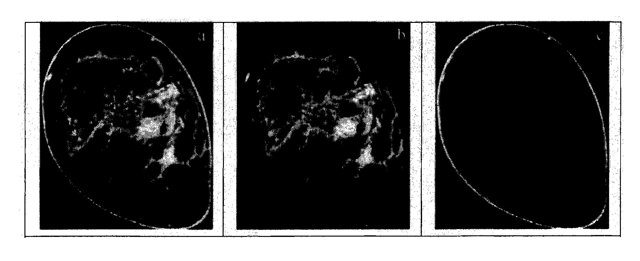 Method and apparatus for cone beam breast CT image-based computer-aided detection and diagnosis