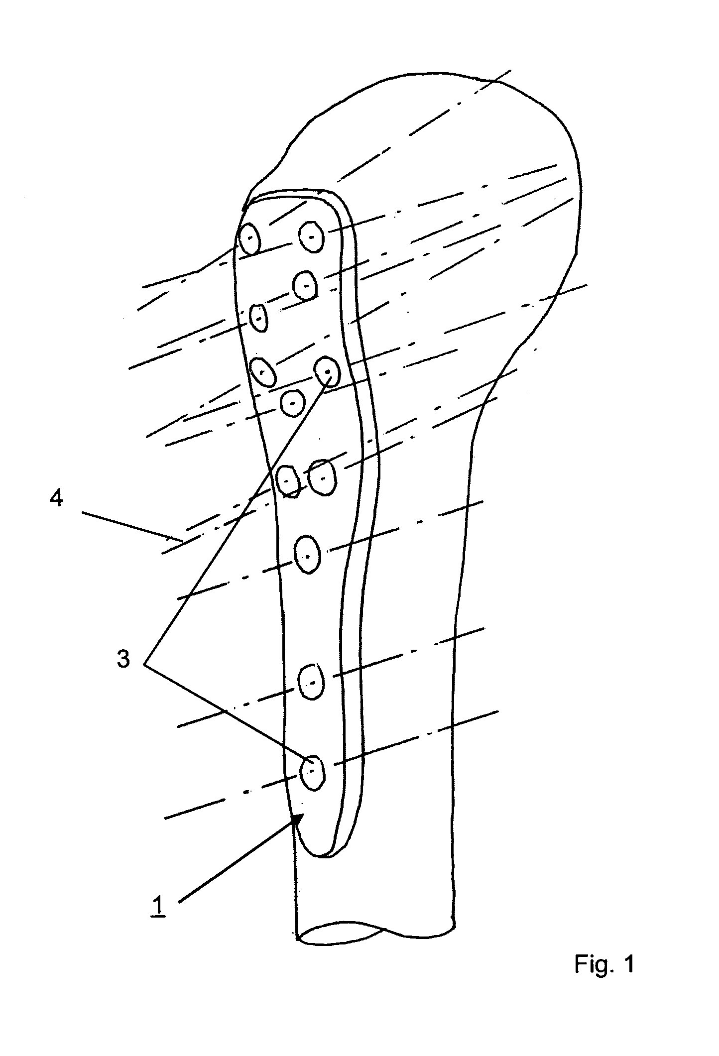 Method for designing and/or optimizing a surgical device