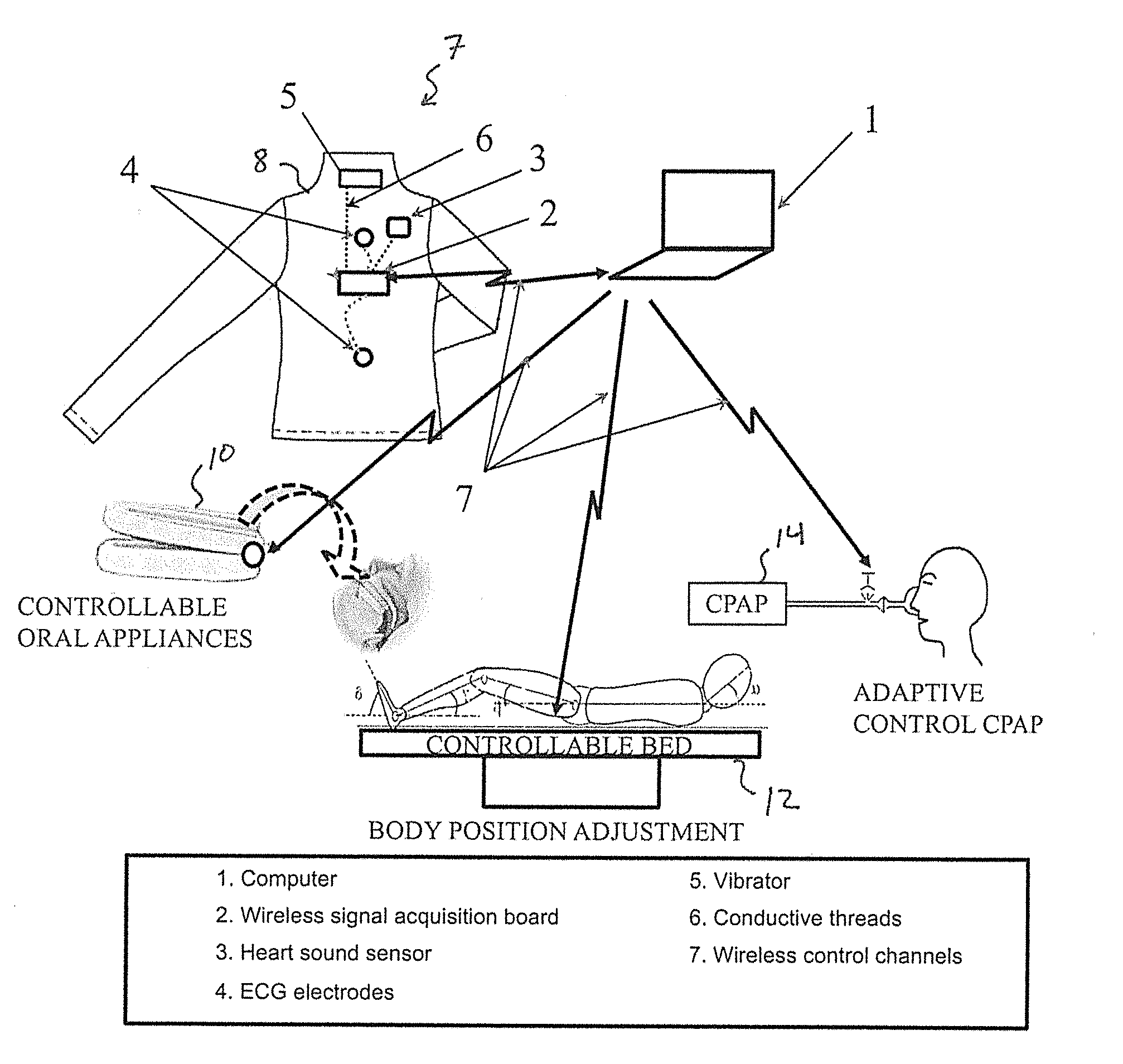 Device and method for predicting and preventing obstructive sleep apnea (OSA) episodes