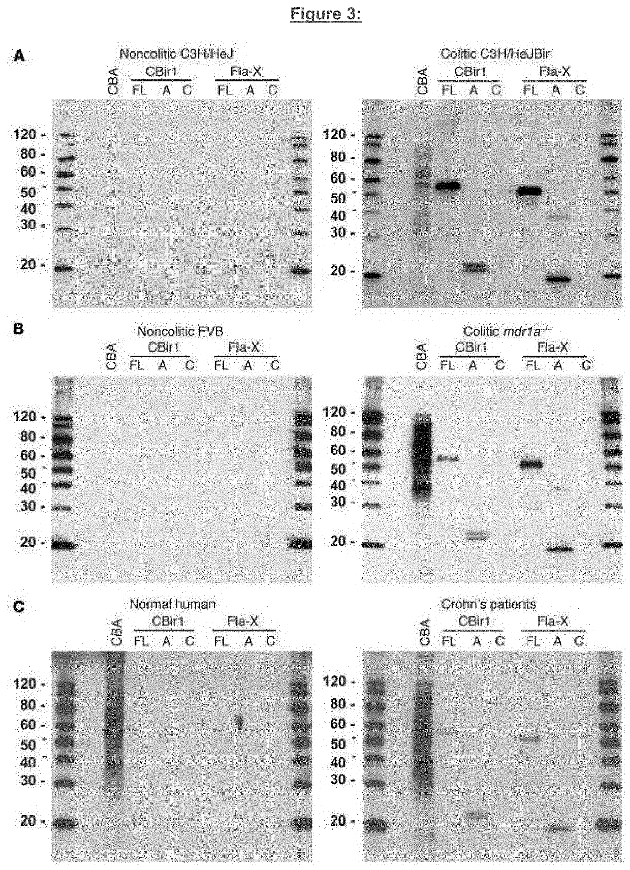 Diagnosis and treatment of inflammatory bowel disease